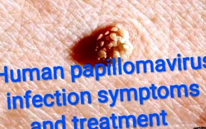 humán papillomavírus kezelese ferfiaknal humán papillomavírus természetes terápia