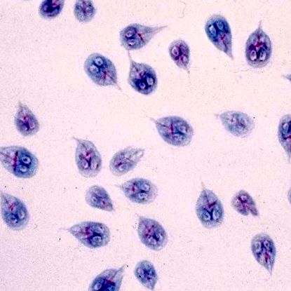 paraziták elleni bőrkrémek mi tilos a Trichomonas szal