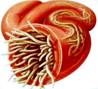 A paraziták elleni küzdelem leghatékonyabb módja Pinwormok elhízhatnak - Pinwormok elhízhatnak