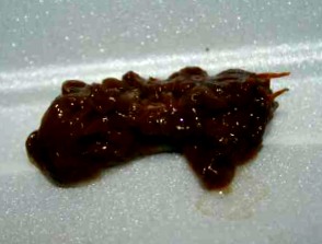 ürülékben lévő pinwormok okozzák