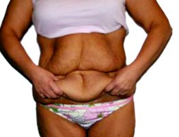 1 hét alatt 2 kg fogyás tippek a kövér has elveszítésére