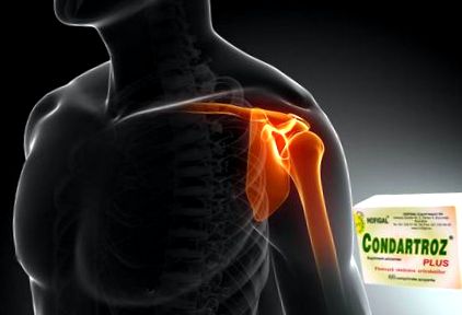 Kondroitin gél mozgatható ízületek áttekintése - Gyógyszerek ízületi fájdalomra