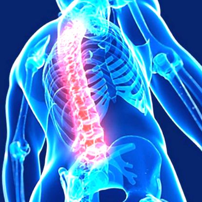 A nyaki osteochondrosis tünetei és kezelése
