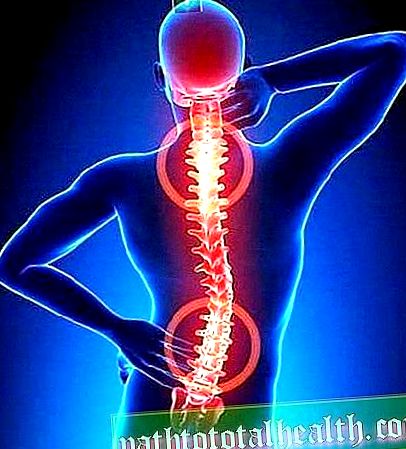 1. stádiumú osteoarthritis fájdalom a lapockák alatt hátulról