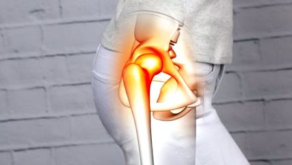 hogyan lehet kezelni a csípő osteoarthritis véleménye ízületi fájdalom parkinson kórban