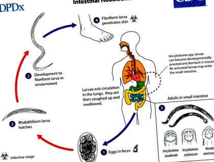 paraziták és giardia helminthiasis fertőzés forrásai és megelőzése