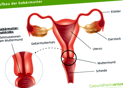 Hpv положително поведение. Hpv impfung wenn schon infiziert. Gardasil Erfahrungen, Bewertungen und Nebenwirkungen - sanego