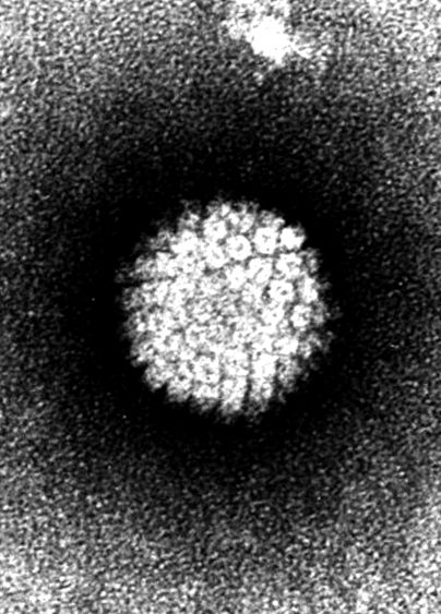 papillomavírus és óvszer