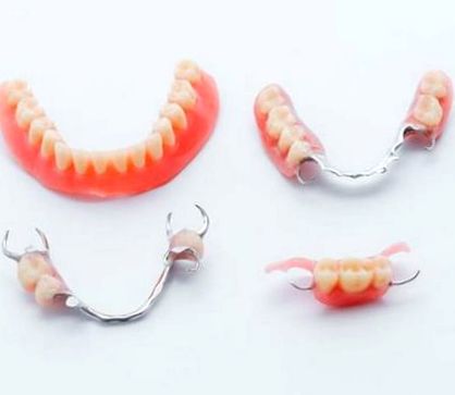 Типове зъбни протези, мобилни, фиксирани, тотални, частични, цени
