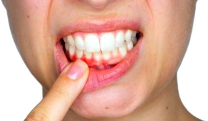 Mit lehet tenni a száj egészségének megőrzéséért?