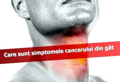 mik a nyaki rák tünetei