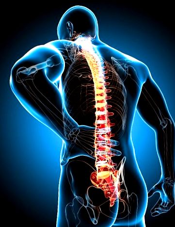 keresztcsont gerinc fájdalma hogyan kell kezelni a csípőízület osteoarthrosisát