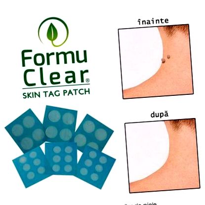 Колан за етикети на кожата FormuClear - лепенки срещу кожни брадавици  Оригинален продукт от Telestar