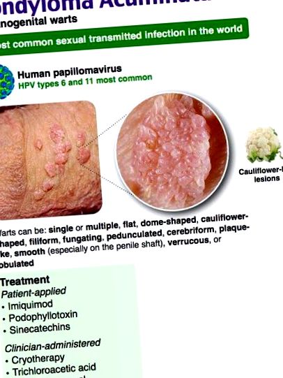 Terhes emberi papillomavírus. Mi a HPV-fertőzés?