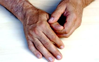 a csukló osteoarthritisének kezelése