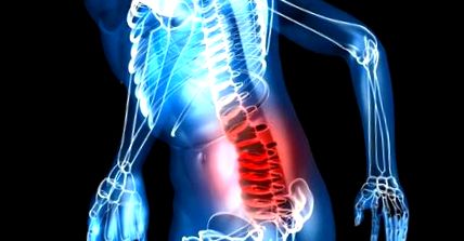fájdalom a gerinc közelében hogyan lehet megszabadulni a nyaki osteochondrosistól