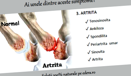 gyulladásos arthrosis