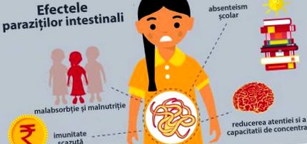 Pinworm fertőzés megelőzése, A pinworm fertőzés jelei felnőtteknél