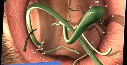 Pinworms egy szoptató anya mellett, Parazita széklet elemzése, Mi lehet benne?