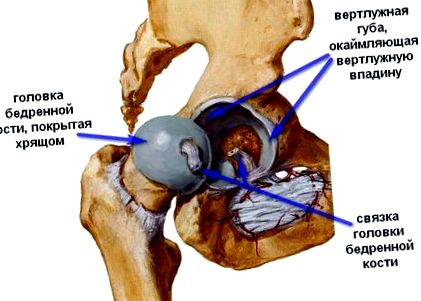 Hogyan történik a csípőcsere műtét - Ortopédia - 2021