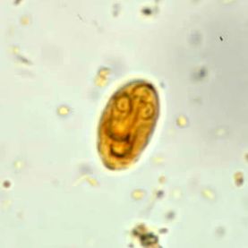 Giardia ciszta paraziták kezelése savanyú lehelet felnőtteknél okoz