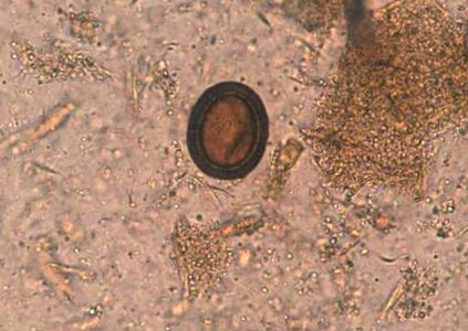 Hogy néznek ki a pinwormok és petéik, Milyen a pinworms a végbélnyíláson