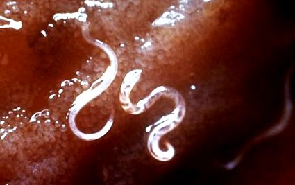 parazita elleni védekezés emberben gyertyák nemi szemölcsökből férfiak számára
