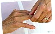 kenőcs ízületi fájdalmak és reuma kezelésére ízületi fájdalom nagy lábujj kezelése