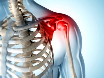 váll osteoarthritis kezelése gyógyszer ízületi fájdalom fenyőolaj