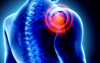 hogyan lehet enyhíteni a fájdalmat a vállízület artrózisával