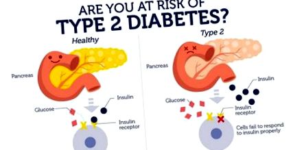 A cukorbetegség diagnosztikai kritériumai - Egészségügyi táplálkozás