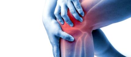 dystrophiás osteoarthritis kezelése gyulladáscsökkentő kenőcsök térdízület artrózisához