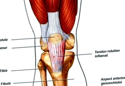 Cauze frecvente ale durerii de genunchi