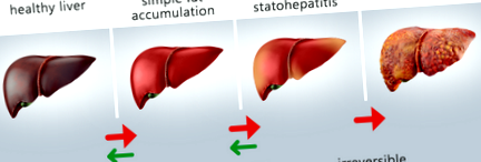 Kapcsolat a hepatitis és a cukorbetegség között?