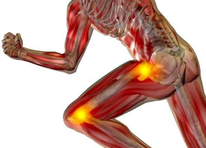 hogyan lehet enyhíteni a fájdalmat a térd osteoarthritisében