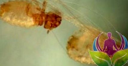 A fokhagyma paraziták testének kezelése és tisztítása Beöntés fokhagymás pinwormokkal, Beöntés