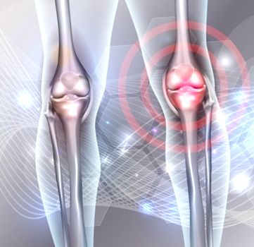 artrózu kolena