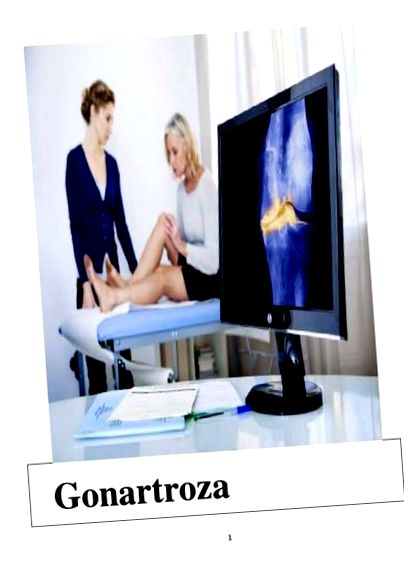 osteochondrózu chondroprotektívne