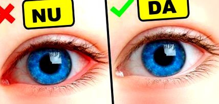 a fejnek rossz a látása látásvizsgálat betűket találni