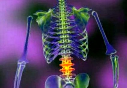 A gerinc nyaki osteochondrosisának hatékony kezelése
