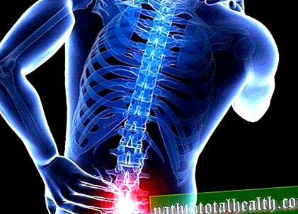 fájdalomcsillapítás az ágyéki gerinc osteochondrosisában)