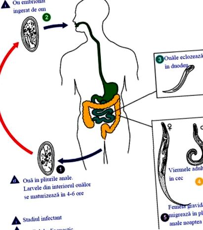 pinworm paraziták terhes nőknél