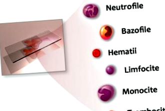 Alacsony neutrofil sejtek (neutropenia) - tünetek, okok, kezelés  Hematológiai vizsgálatok