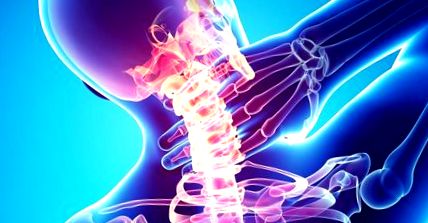 kenőcs a nyaki osteochondrosishoz fájó fájdalmak az ízületekben