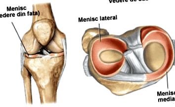 Ízületi gyulladás (artritisz), Hogyan enyhíthető a láb ízületi gyulladása