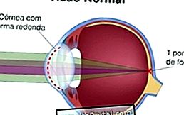 Lehetséges-e gyógyítani a látást asztigmatizmussal?, Asztigmatizmus gyógyítja a látást