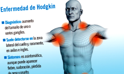 Hodgkin-rák tünetei EXTRA AJÁNLÓ