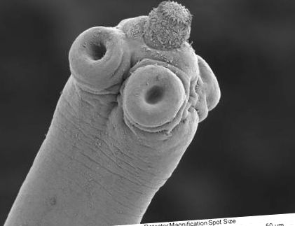 Honnan származnak az emberi pinwormok, Honnan származnak az emberi pinwormok
