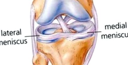 A térd medialis meniscusának repedése