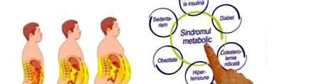 Metabolikus szindróma - 4 tünet együttes kezelése